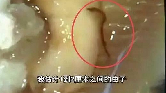 一只生蠔引起的冤案，觸動了餐飲人的“麻木神經”